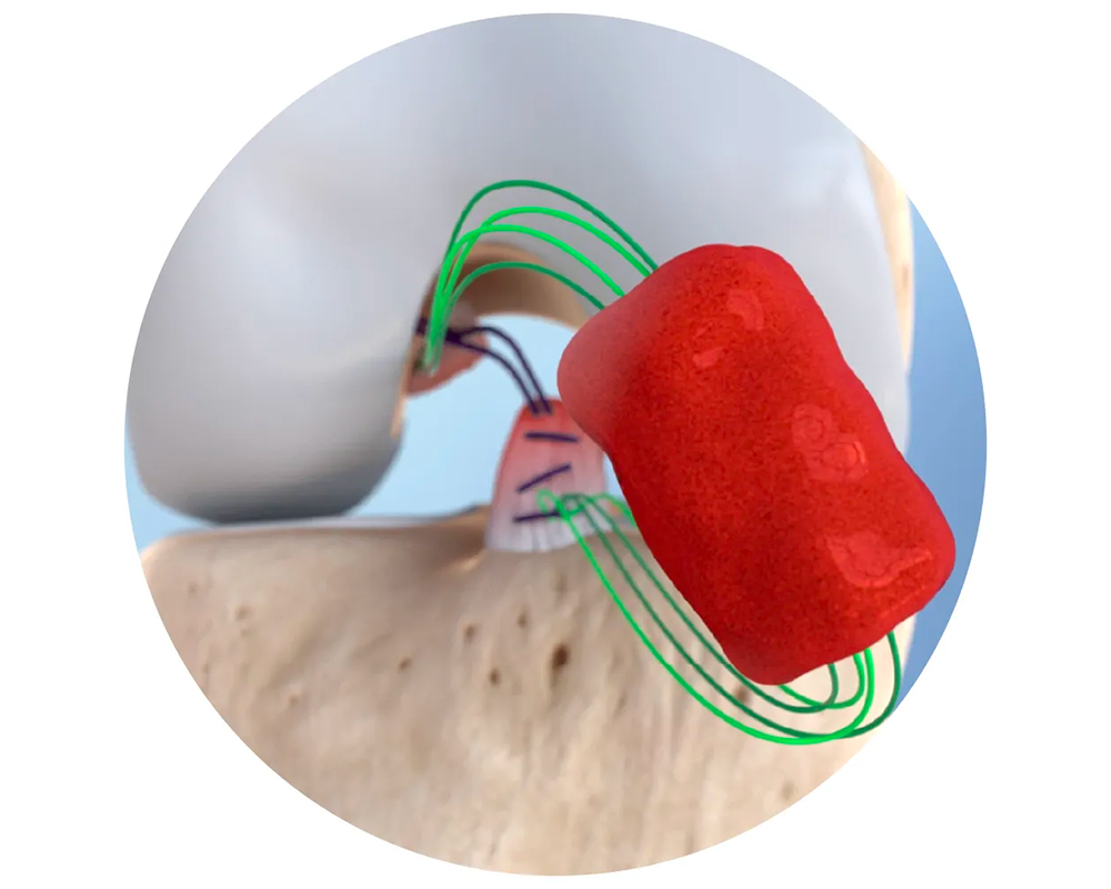 Image is not available