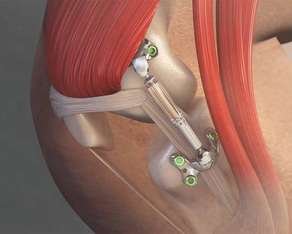 Image is not available